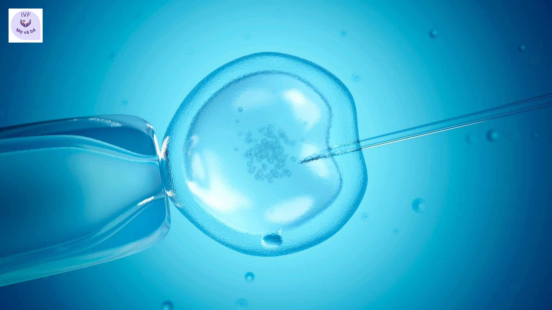 Điều trị vô sinh bằng phương pháp ICSI